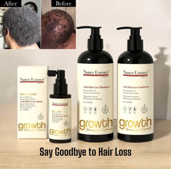Anti-Hair Loss Restore Max Kit - Image 2